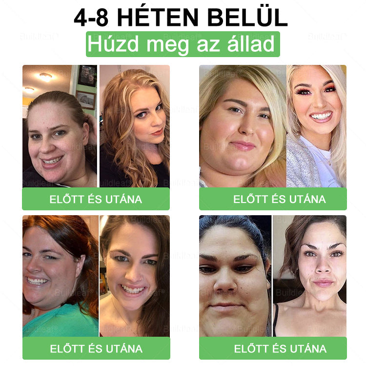 đšââïž Klinikai kutatĂĄsokkal igazolt | A BuildLeafÂź Berberine GLP-1 Pro SĂșlycsökkentĆ SzĂĄjon ĂĄt szedhetĆ oldat segĂthet a makacs sĂșlytöbblet, anyagcsere- Ă©s energiaproblĂ©mĂĄk kezelĂ©sĂ©ben, tĂĄmogatva a jobb közĂ©rzetet Ă©s vitalitĂĄst