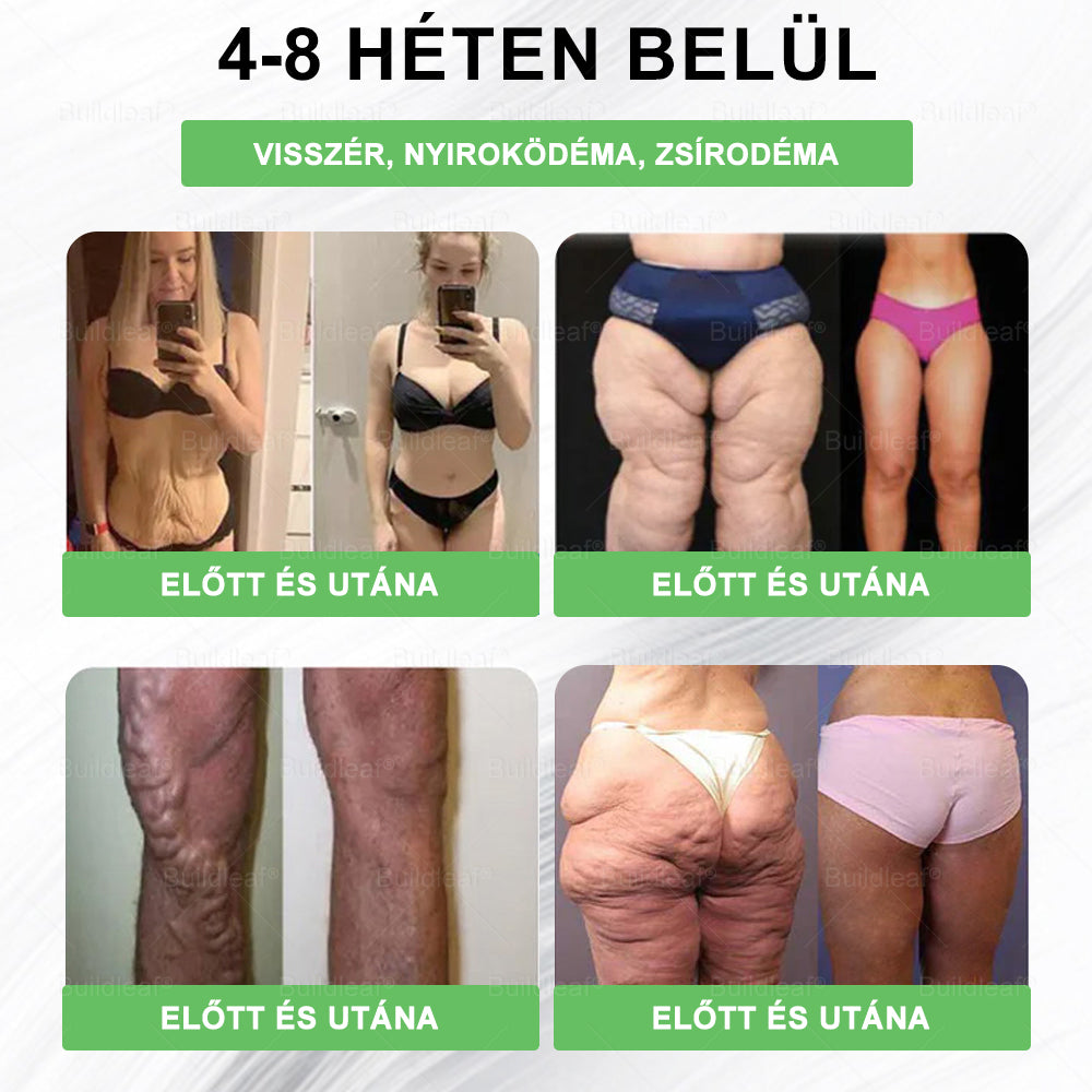 🎁 Már csak 5 doboz maradt! Most további 50% kedvezményt adunk! Legyél fitt és egészséges. Ha most nem élsz a lehetőséggel, legközelebb csak jövőre lesz rá esélyed!